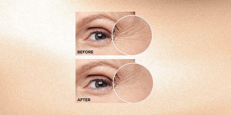 In Article Reasons To Use Serum RevitaLift Derm Intensives 15 Pure Hyaluronic Acid Serum